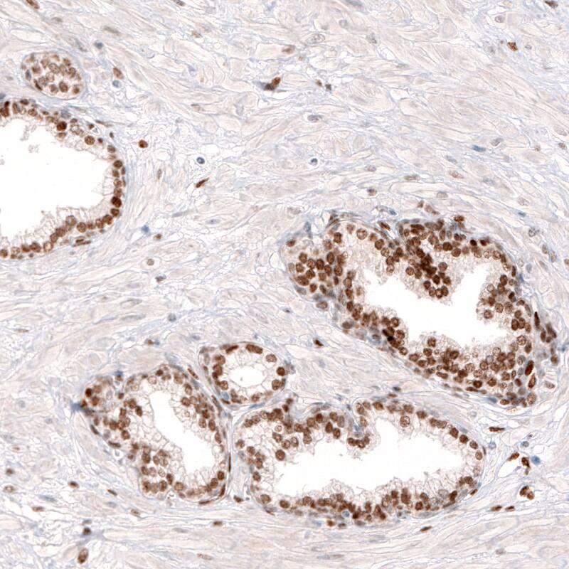 KLF4 Antibody (CL5782) - Azide and BSA Free Immunohistochemistry-Paraffin: KLF4 Antibody [NBP3-44207]