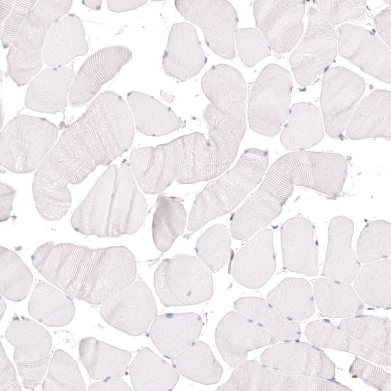 KLF4 Antibody (CL5782) - Azide and BSA Free Immunohistochemistry-Paraffin: KLF4 Antibody [NBP3-44207]