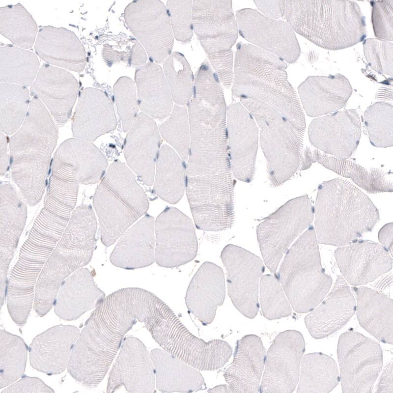 KLF4 Antibody (CL5785) - Azide and BSA Free Immunohistochemistry-Paraffin: KLF4 Antibody [NBP3-44208]