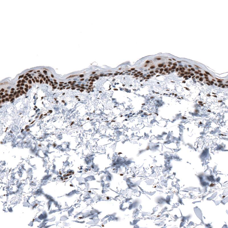 KLF4 Antibody (CL5785) - Azide and BSA Free Immunohistochemistry-Paraffin: KLF4 Antibody [NBP3-44208]