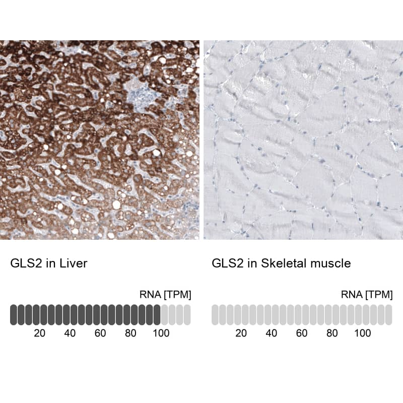 GLS2 Antibody (CL7716) - Azide and BSA Free Immunohistochemistry-Paraffin: GLS2 Antibody [NBP3-44209]