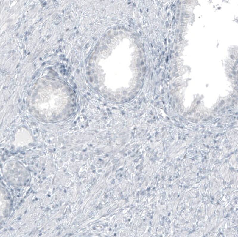 GLS2 Antibody (CL7716) - Azide and BSA Free Immunohistochemistry-Paraffin: GLS2 Antibody [NBP3-44209]