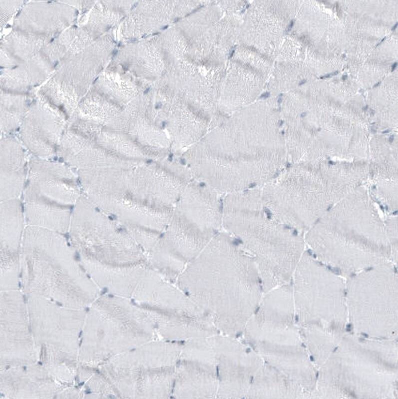 GLS2 Antibody (CL7716) - Azide and BSA Free Immunohistochemistry-Paraffin: GLS2 Antibody [NBP3-44209]