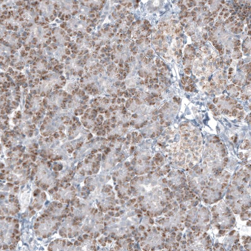 GLS2 Antibody (CL7716) - Azide and BSA Free Immunohistochemistry-Paraffin: GLS2 Antibody [NBP3-44209]
