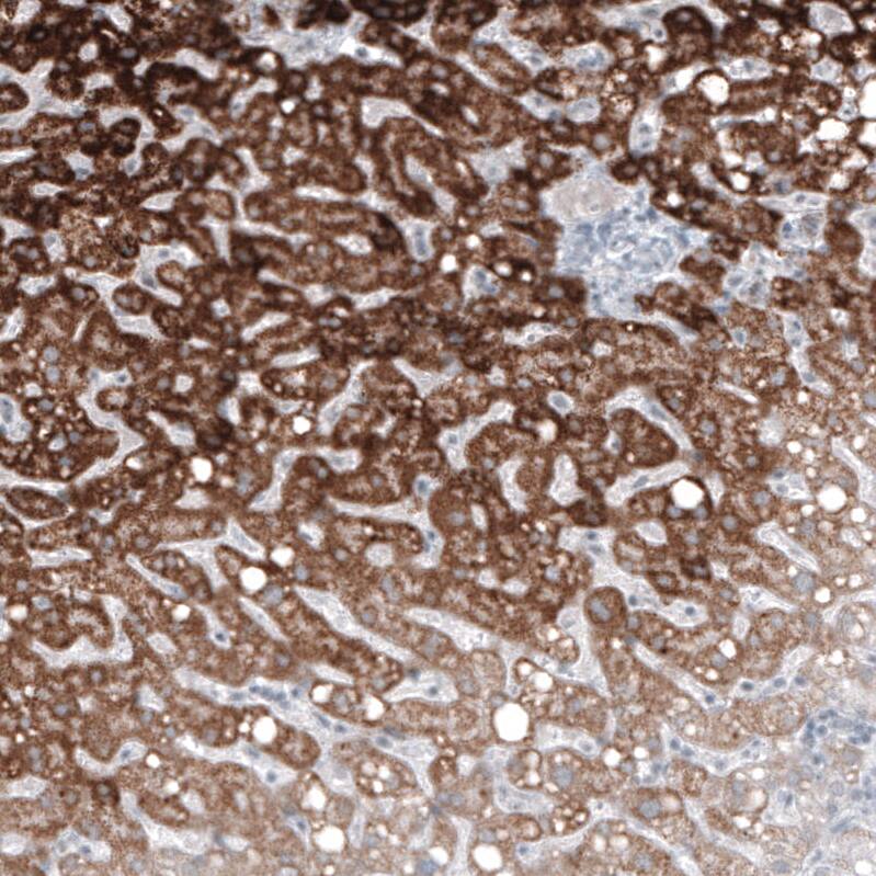 GLS2 Antibody (CL7716) - Azide and BSA Free Immunohistochemistry-Paraffin: GLS2 Antibody [NBP3-44209]