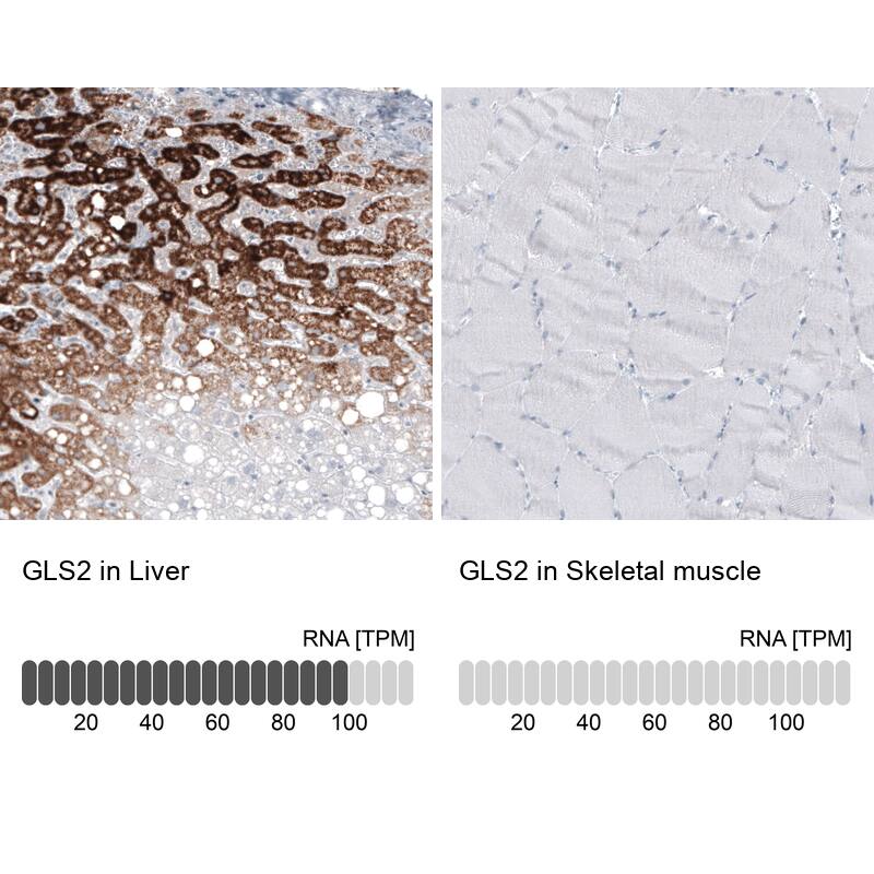 GLS2 Antibody (CL7721) - Azide and BSA Free Immunohistochemistry-Paraffin: GLS2 Antibody [NBP3-44210]