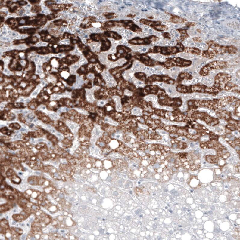 GLS2 Antibody (CL7721) - Azide and BSA Free Immunohistochemistry-Paraffin: GLS2 Antibody [NBP3-44210]
