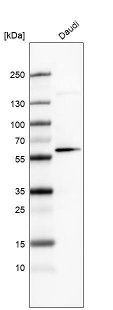 GLS2 Antibody (CL7721) - Azide and BSA Free Western Blot: GLS2 Antibody [NBP3-44210]