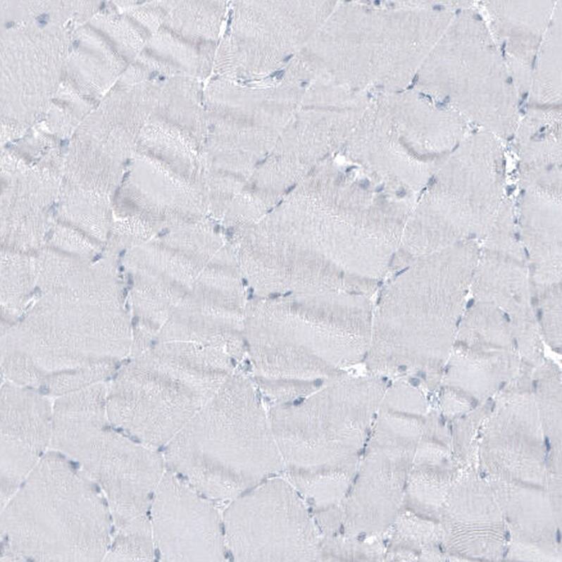 GLS2 Antibody (CL7721) - Azide and BSA Free Immunohistochemistry-Paraffin: GLS2 Antibody [NBP3-44210]