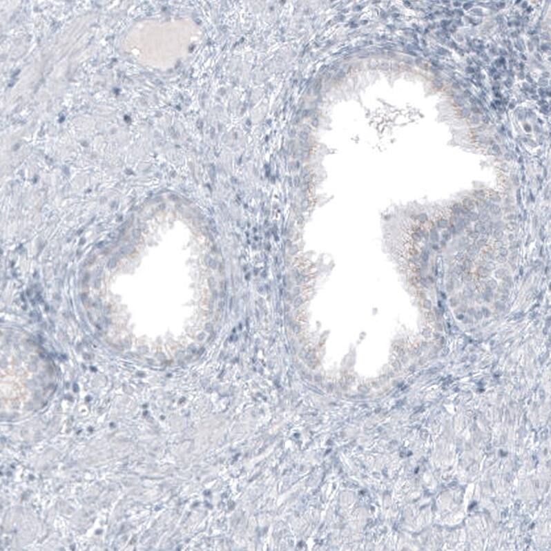 GLS2 Antibody (CL7721) - Azide and BSA Free Immunohistochemistry-Paraffin: GLS2 Antibody [NBP3-44210]