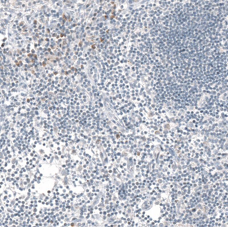 IL-17/IL-17A Antibody (CL10252) - Azide and BSA Free Immunohistochemistry-Paraffin: IL-17/IL-17A Antibody [NBP3-44212]
