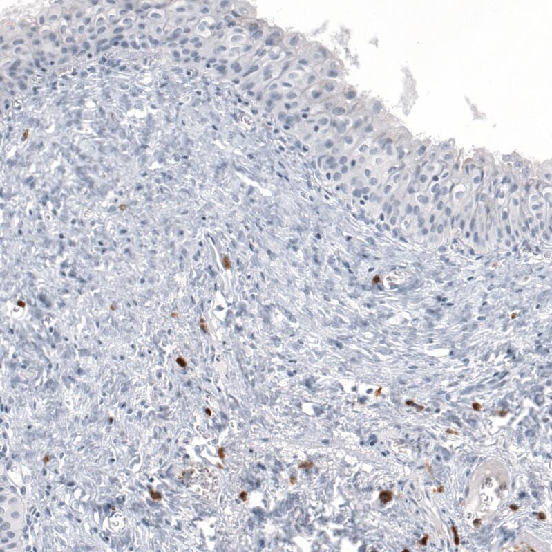 IL-17/IL-17A Antibody (CL10252) - Azide and BSA Free Immunohistochemistry-Paraffin: IL-17/IL-17A Antibody [NBP3-44212]