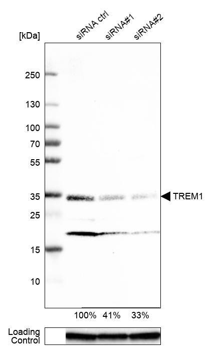 TREM1 Antibody (CL7111) - Azide and BSA Free Western Blot: TREM1 Antibody [NBP3-44214]
