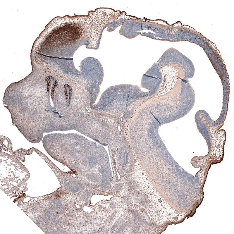 LHX2 Antibody (CL6137) - Azide and BSA Free Immunohistochemistry-Paraffin: LHX2 Antibody [NBP3-44215]