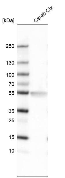 LHX2 Antibody (CL6137) - Azide and BSA Free Western Blot: LHX2 Antibody [NBP3-44215]