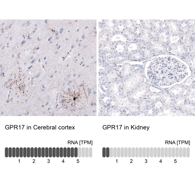 GPR17 Antibody (CL10474) - Azide and BSA Free Immunohistochemistry-Paraffin: GPR17 Antibody [NBP3-44216]