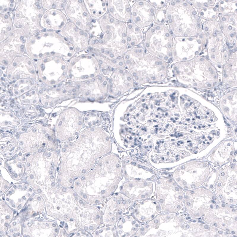 GPR17 Antibody (CL10474) - Azide and BSA Free Immunohistochemistry-Paraffin: GPR17 Antibody [NBP3-44216]
