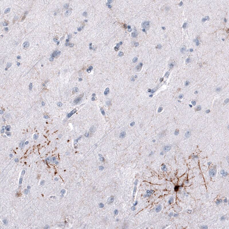GPR17 Antibody (CL10474) - Azide and BSA Free Immunohistochemistry-Paraffin: GPR17 Antibody [NBP3-44216]