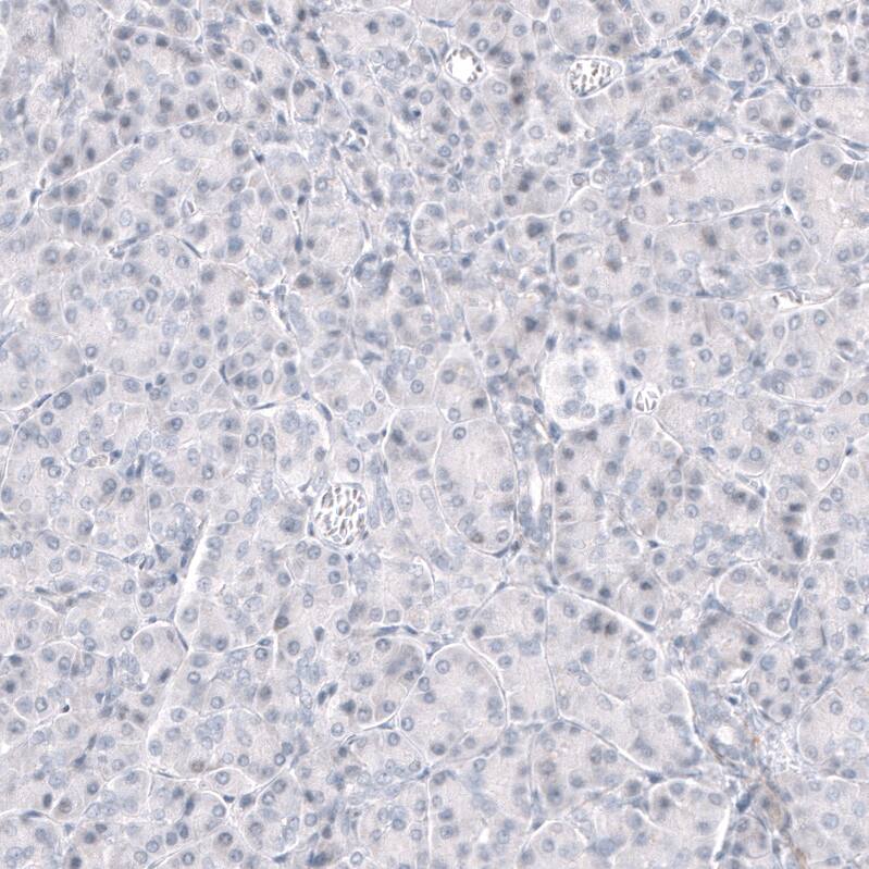 GPR17 Antibody (CL10474) - Azide and BSA Free Immunohistochemistry-Paraffin: GPR17 Antibody [NBP3-44216]