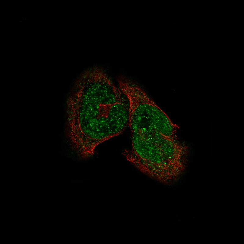HDAC5 Antibody (CL8121) - Azide and BSA Free Immunocytochemistry/ Immunofluorescence: HDAC5 Antibody [NBP3-44217]