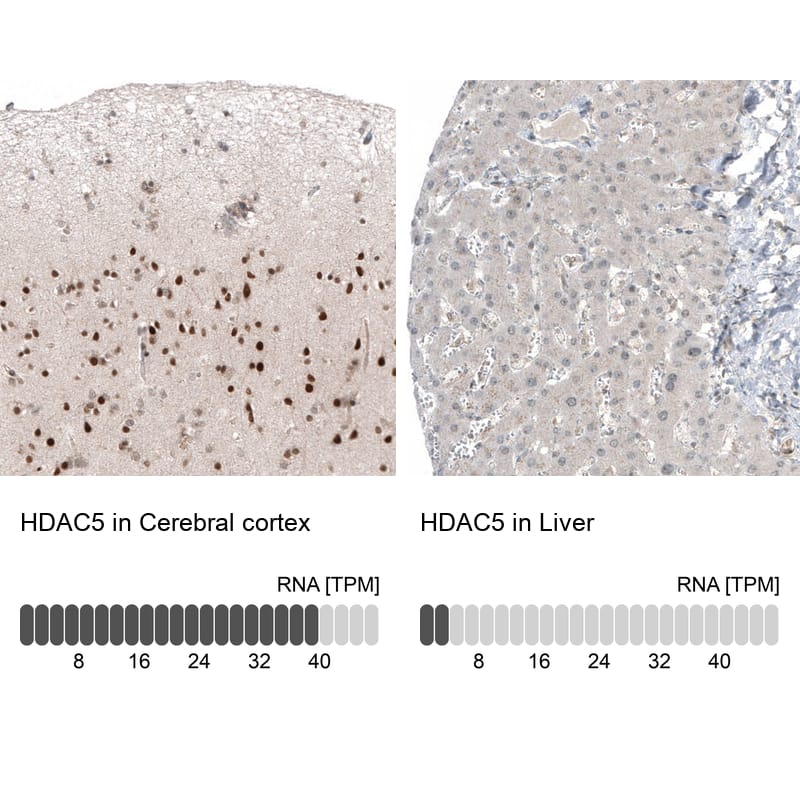 HDAC5 Antibody (CL8121) - Azide and BSA Free Immunohistochemistry-Paraffin: HDAC5 Antibody [NBP3-44217]