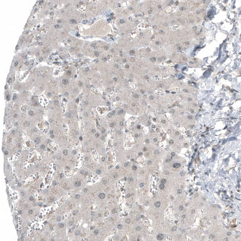 HDAC5 Antibody (CL8121) - Azide and BSA Free Immunohistochemistry-Paraffin: HDAC5 Antibody [NBP3-44217]