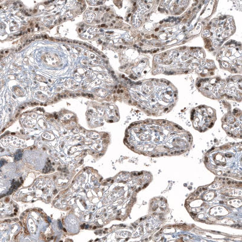 HDAC5 Antibody (CL8121) - Azide and BSA Free Immunohistochemistry-Paraffin: HDAC5 Antibody [NBP3-44217]