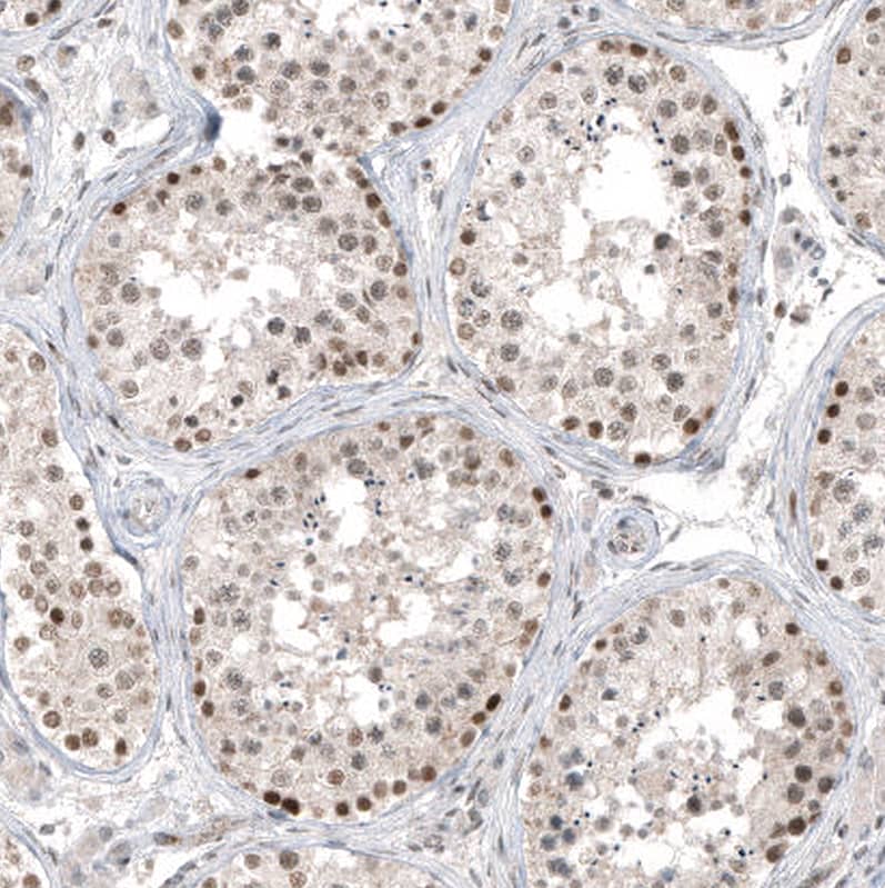 HDAC5 Antibody (CL8121) - Azide and BSA Free Immunohistochemistry-Paraffin: HDAC5 Antibody [NBP3-44217]