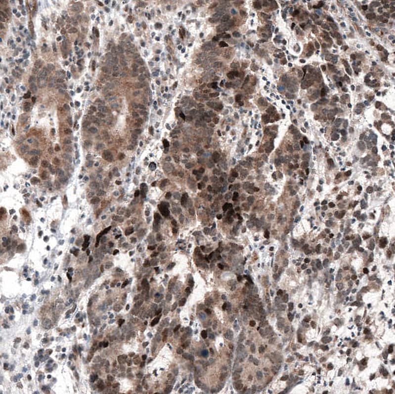 HDAC5 Antibody (CL8121) - Azide and BSA Free Immunohistochemistry-Paraffin: HDAC5 Antibody [NBP3-44217]