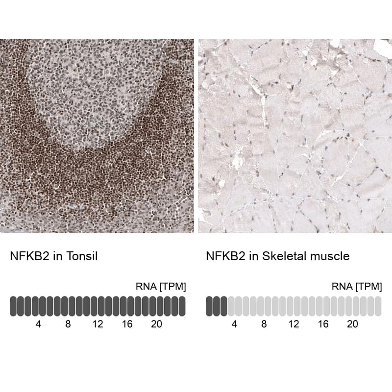 NFkB2/NFkB p100 Antibody (CL8266) - Azide and BSA Free Immunohistochemistry-Paraffin: NFkB2/NFkB p100 Antibody [NBP3-44219]