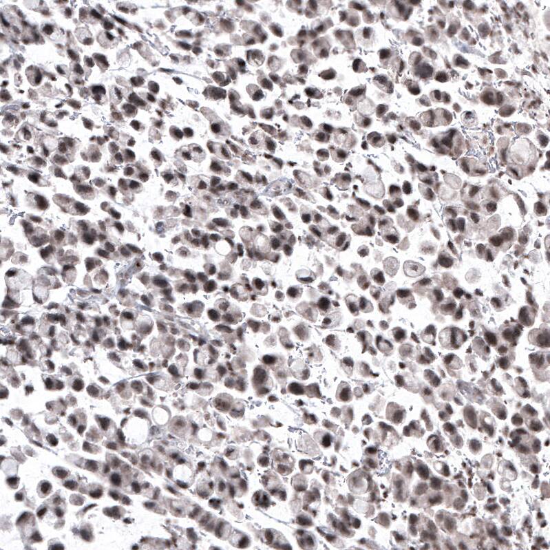 NFkB2/NFkB p100 Antibody (CL8266) - Azide and BSA Free Immunohistochemistry-Paraffin: NFkB2/NFkB p100 Antibody [NBP3-44219]