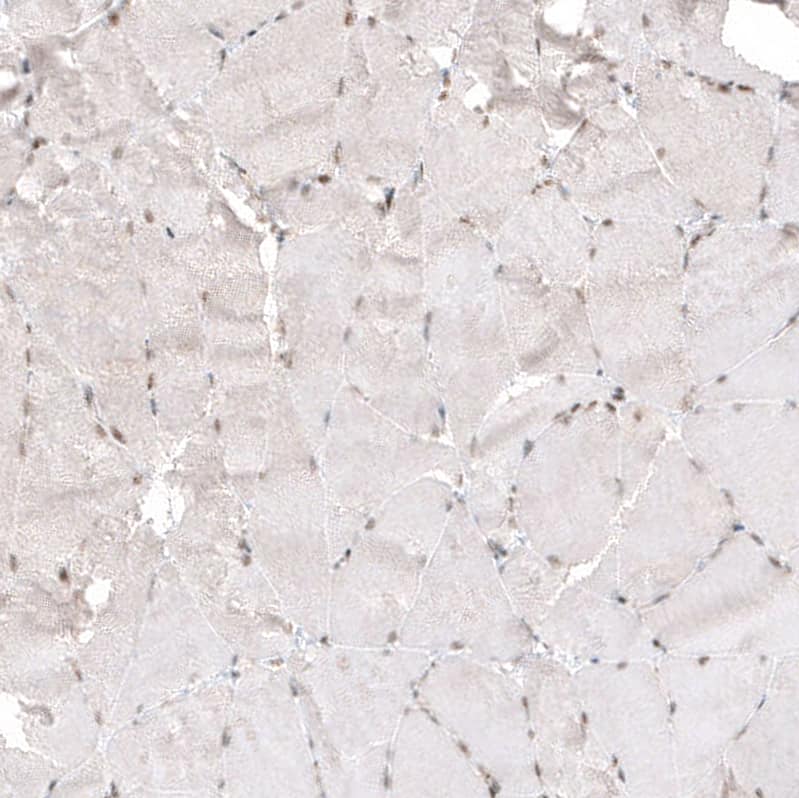 NFkB2/NFkB p100 Antibody (CL8266) - Azide and BSA Free Immunohistochemistry-Paraffin: NFkB2/NFkB p100 Antibody [NBP3-44219]