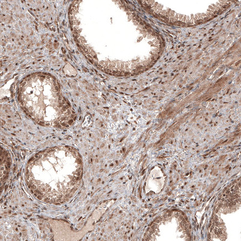 CDK4 Antibody (CL8102) - Azide and BSA Free Immunohistochemistry-Paraffin: CDK4 Antibody [NBP3-44220]