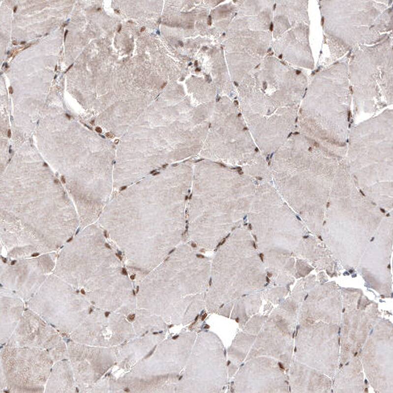 CDK4 Antibody (CL8102) - Azide and BSA Free Immunohistochemistry-Paraffin: CDK4 Antibody [NBP3-44220]