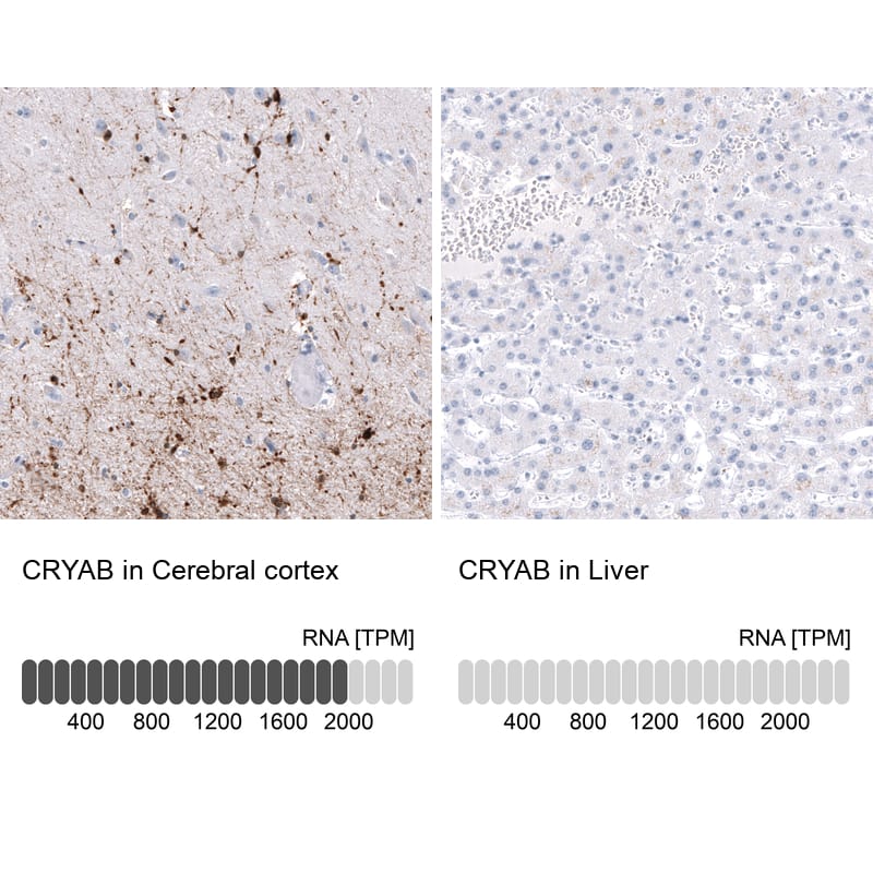AlphaB Crystallin/CRYAB Antibody (CL10765) - Azide and BSA Free Immunohistochemistry-Paraffin: AlphaB Crystallin/CRYAB Antibody [NBP3-44221]