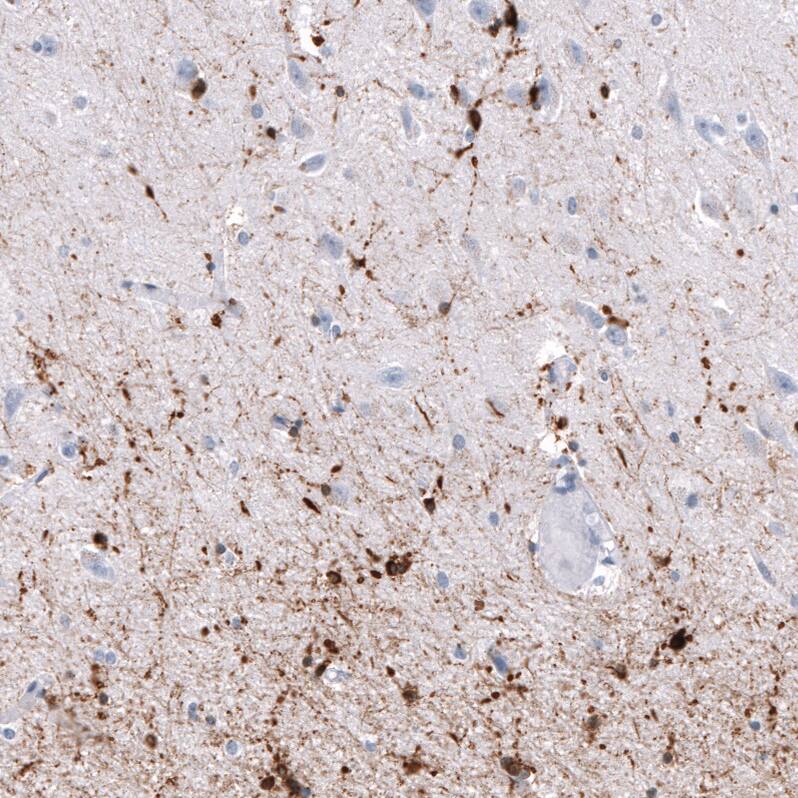 AlphaB Crystallin/CRYAB Antibody (CL10765) - Azide and BSA Free Immunohistochemistry-Paraffin: AlphaB Crystallin/CRYAB Antibody [NBP3-44221]
