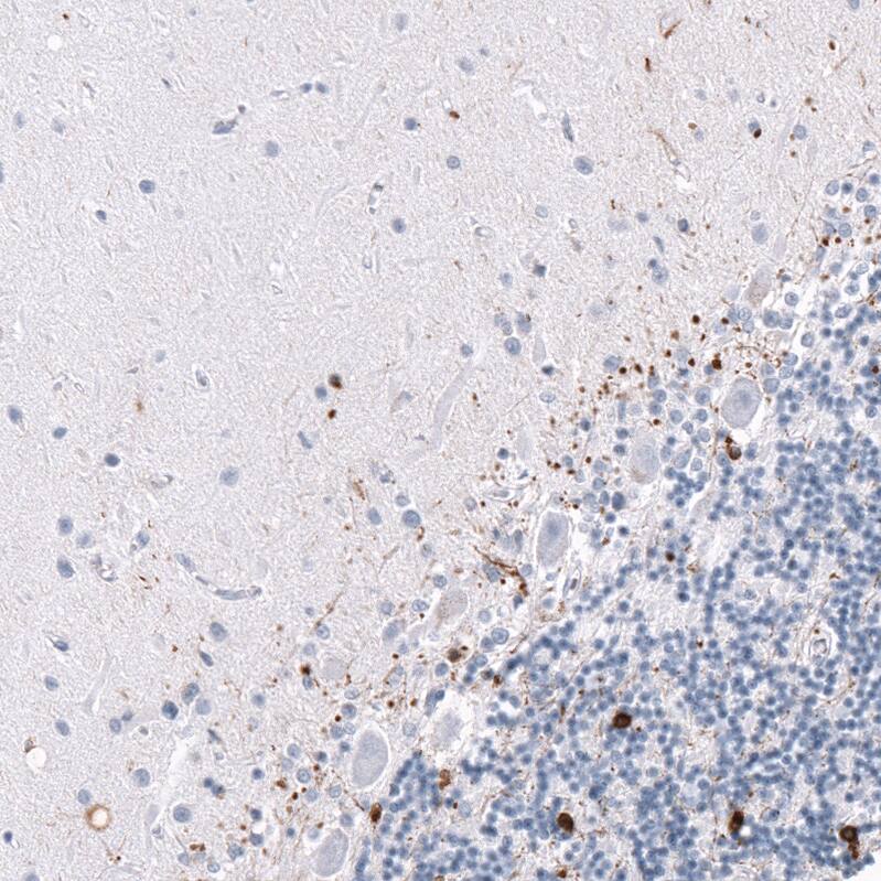 AlphaB Crystallin/CRYAB Antibody (CL10765) - Azide and BSA Free Immunohistochemistry-Paraffin: AlphaB Crystallin/CRYAB Antibody [NBP3-44221]