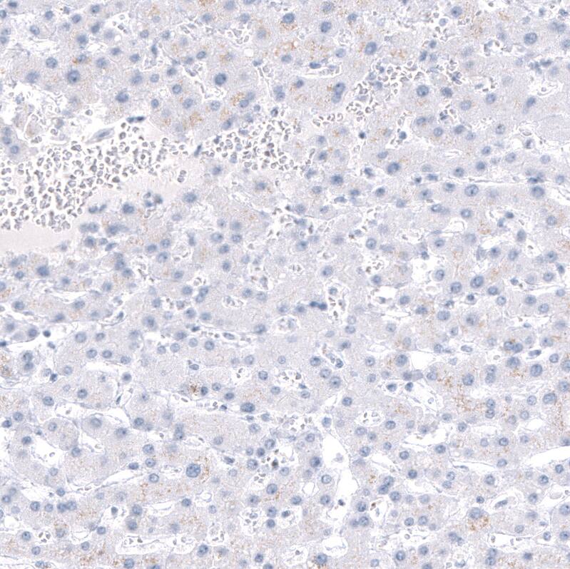 AlphaB Crystallin/CRYAB Antibody (CL10765) - Azide and BSA Free Immunohistochemistry-Paraffin: AlphaB Crystallin/CRYAB Antibody [NBP3-44221]