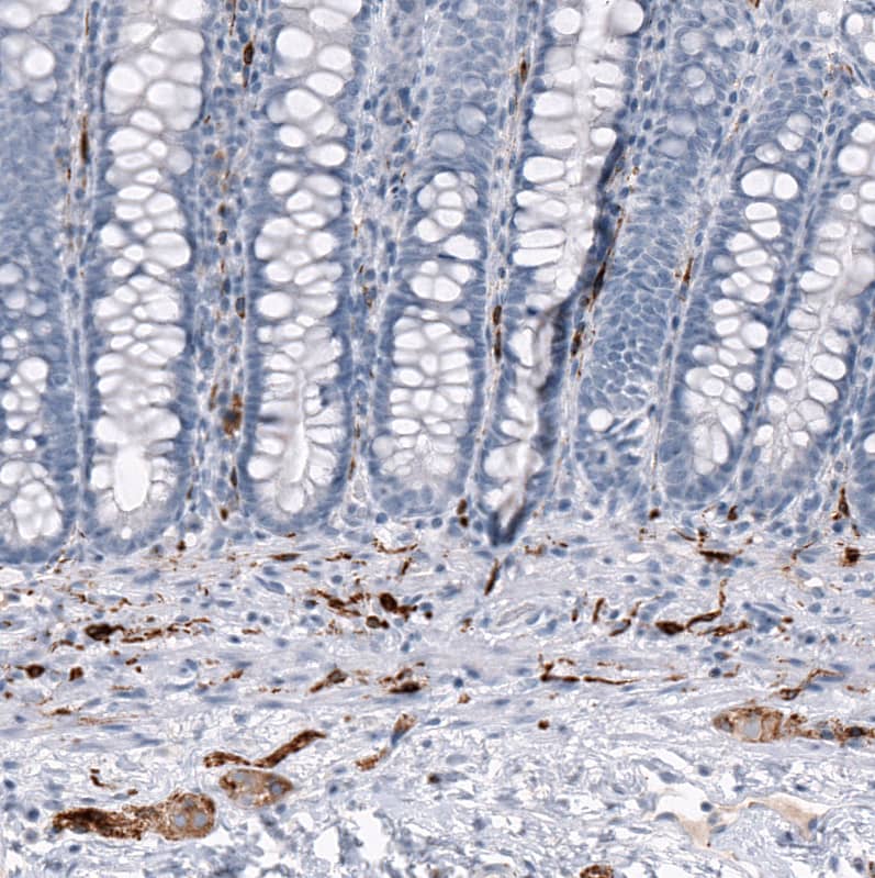 AlphaB Crystallin/CRYAB Antibody (CL10765) - Azide and BSA Free Immunohistochemistry-Paraffin: AlphaB Crystallin/CRYAB Antibody [NBP3-44221]
