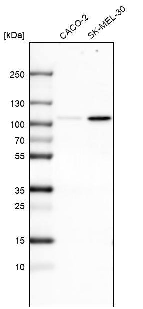 SOX6 Antibody (CL5685) - Azide and BSA Free Western Blot: SOX6 Antibody [NBP3-44222]