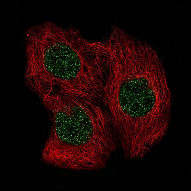 SOX6 Antibody (CL5690) - Azide and BSA Free Immunocytochemistry/ Immunofluorescence: SOX6 Antibody [NBP3-44223]