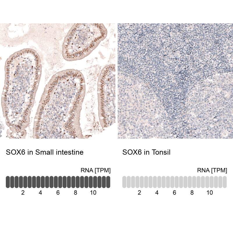 SOX6 Antibody (CL5690) - Azide and BSA Free Immunohistochemistry-Paraffin: SOX6 Antibody [NBP3-44223]