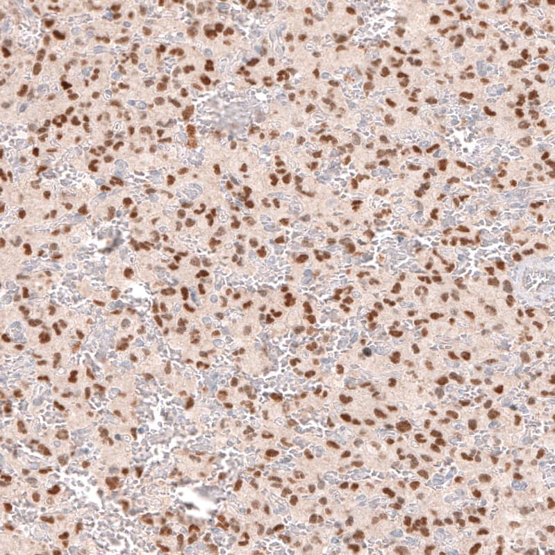 SOX6 Antibody (CL5690) - Azide and BSA Free Immunohistochemistry-Paraffin: SOX6 Antibody [NBP3-44223]