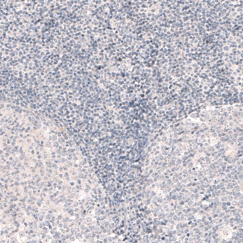 SOX6 Antibody (CL5690) - Azide and BSA Free Immunohistochemistry-Paraffin: SOX6 Antibody [NBP3-44223]