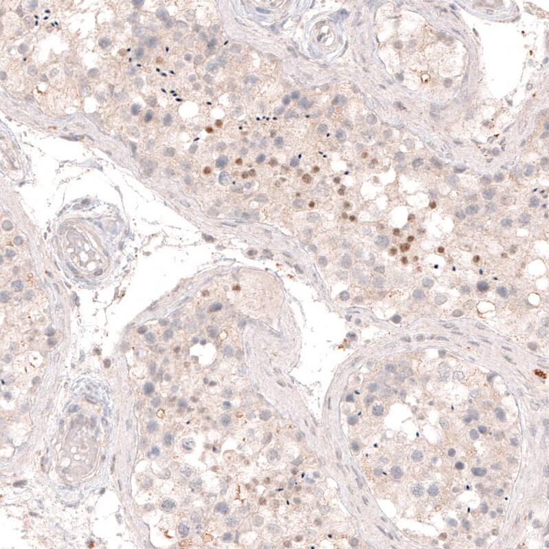 SOX6 Antibody (CL5690) - Azide and BSA Free Immunohistochemistry-Paraffin: SOX6 Antibody [NBP3-44223]