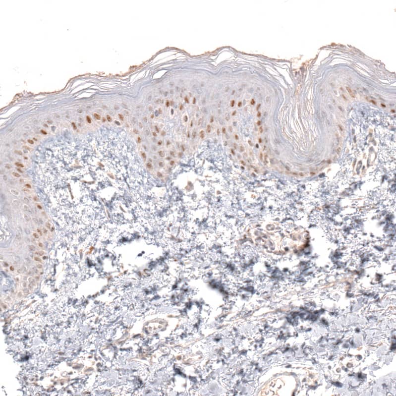 SOX6 Antibody (CL5690) - Azide and BSA Free Immunohistochemistry-Paraffin: SOX6 Antibody [NBP3-44223]