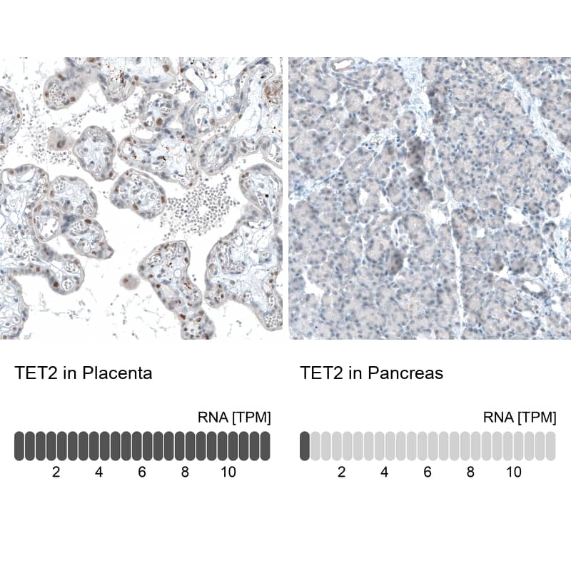 TET2 Antibody (CL6873) - Azide and BSA Free Immunohistochemistry-Paraffin: TET2 Antibody [NBP3-44224]