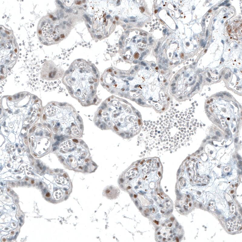 TET2 Antibody (CL6873) - Azide and BSA Free Immunohistochemistry-Paraffin: TET2 Antibody [NBP3-44224]