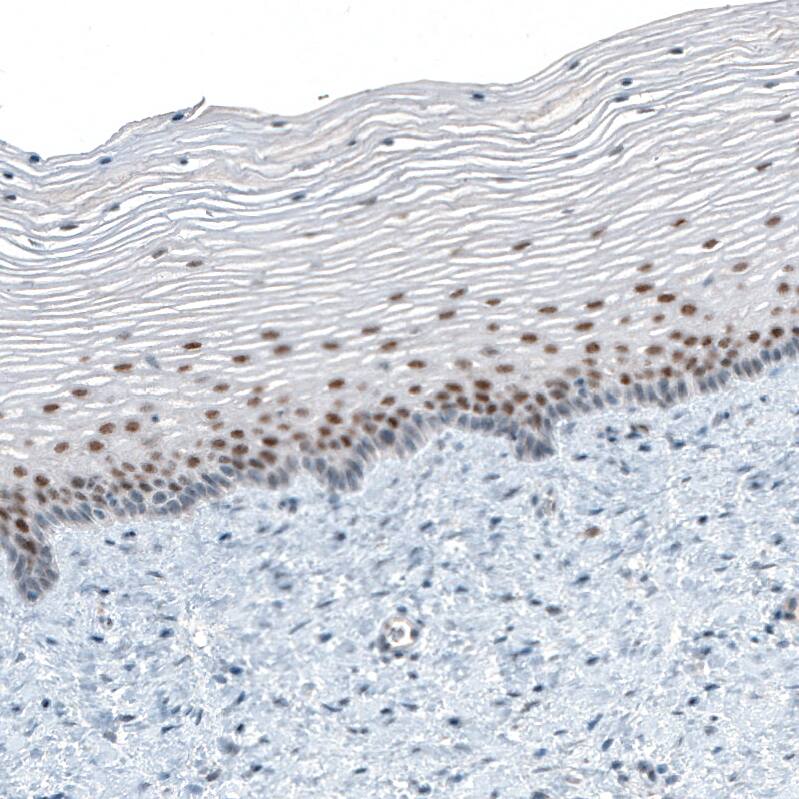 TET2 Antibody (CL6873) - Azide and BSA Free Immunohistochemistry-Paraffin: TET2 Antibody [NBP3-44224]