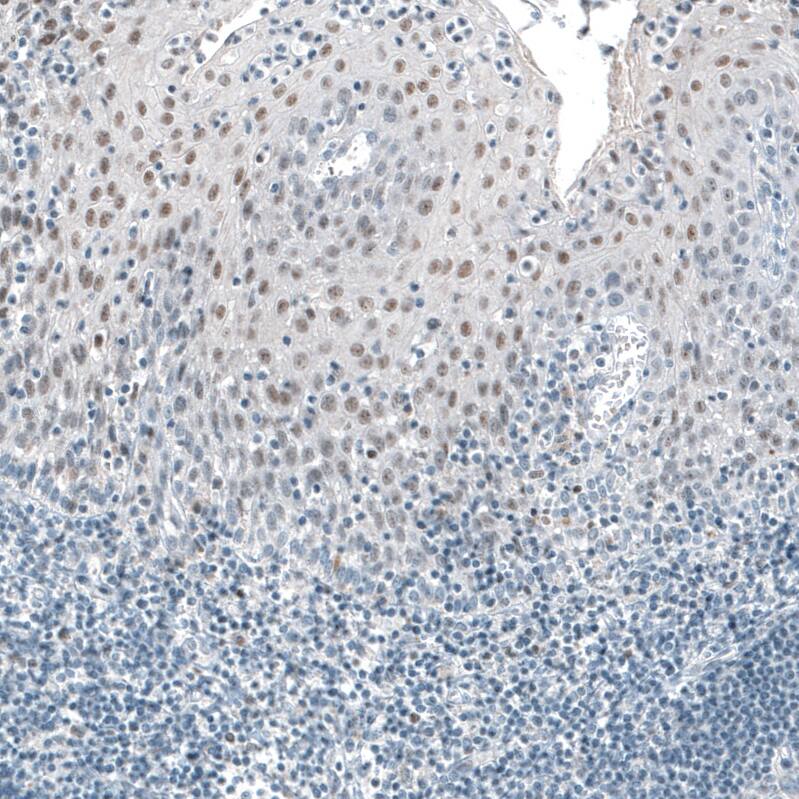 TET2 Antibody (CL6873) - Azide and BSA Free Immunohistochemistry-Paraffin: TET2 Antibody [NBP3-44224]